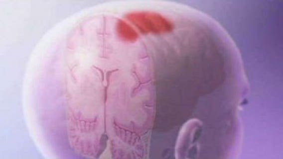 Joint concussion study announced: Obama calls for end to "suck it up" culture in sports