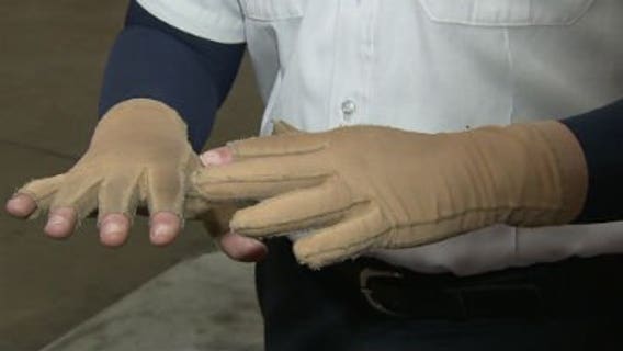 Milwaukee firefighter back on the job after June duplex explosion