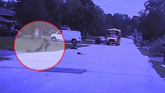 Police update investigation into dog attack on girls; chief says "I’ve never seen an incident this horrific"