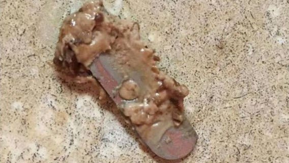 13-year-old injured after biting into razor hidden in Halloween candy bar, mom says