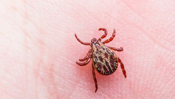 Bad tick season approaching, UW Health experts say