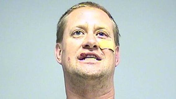 Two Walworth Co. deputies bitten by pit bulls during arrest