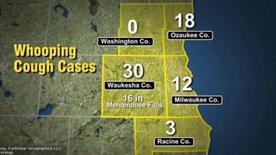 Health Dept. sees increased number of whooping cough cases