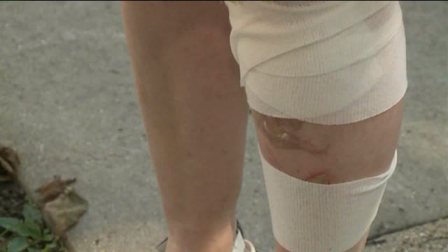 "I asked God for help:" After robbery victim set on fire, neighbor who rushed to help him prays for his recovery