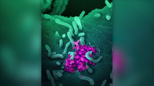 Cruise returning to San Francisco early after ex-passenger dies of coronavirus