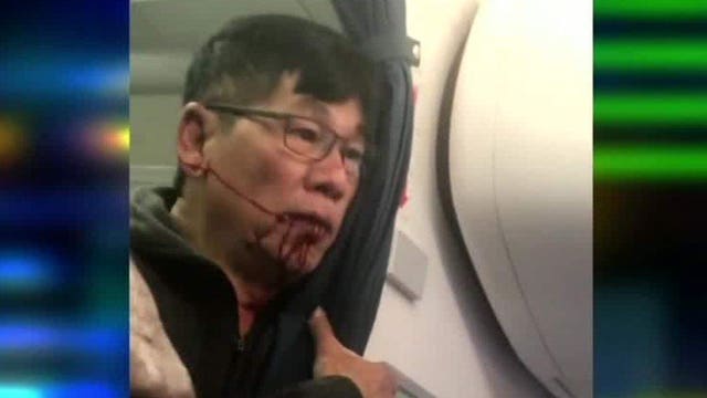 United CEO apologizes for 'truly horrific' passenger incident: "I promise you we will do better"
