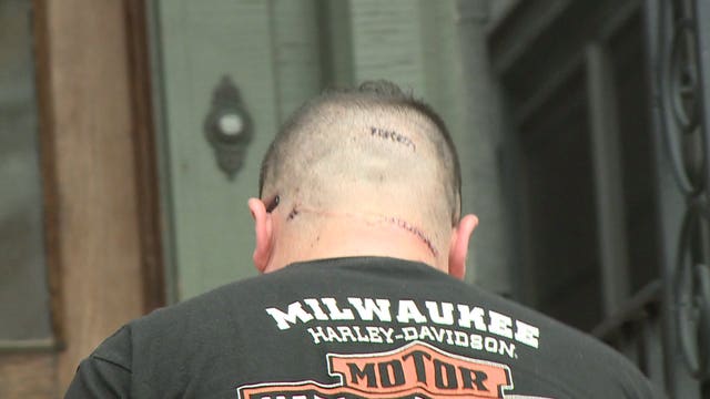 Man gets 50 stitches after intruder stabs him inside home on Milwaukee's east side