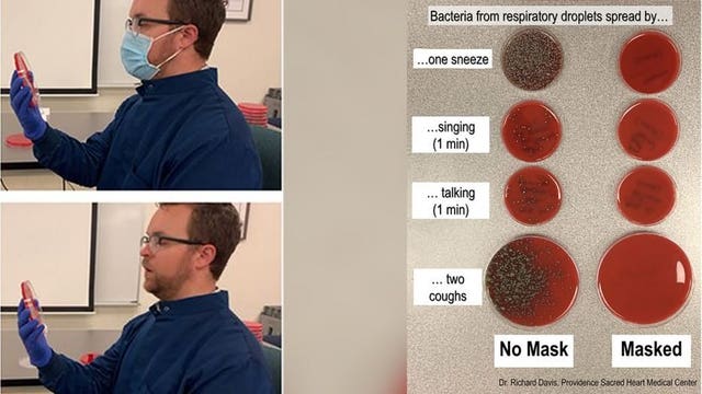 Doctor demonstrates how face mask blocks respiratory droplets from spreading