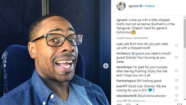 Brewers OF Curtis Granderson sports new smile after helmet incident