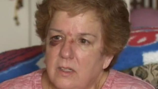 'Hit me like a ton of bricks:' Woman says hot dog gave her a black eye at Phillies/Cardinals game