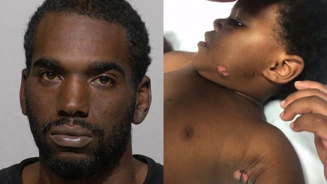 10+ years in prison for man who admitted to burning boy because he was ‘mad’ at his mom