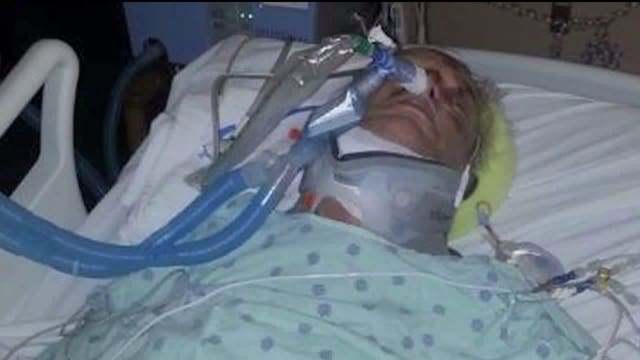 Man dies 4 years after hit-and-run; suspect in case sentenced to 1 year in prison