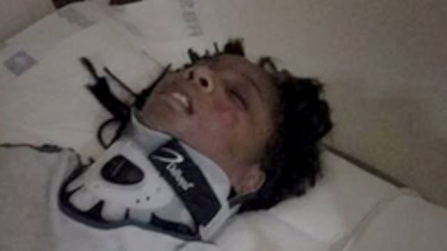 Father of girl ejected from stolen car shares pictures he wants everyone to see: "This could cost your life"