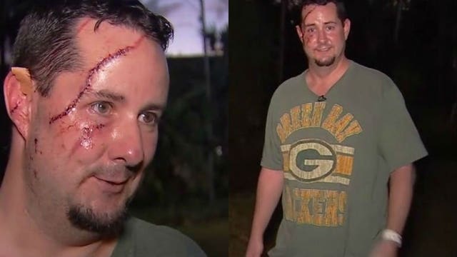 Bear vs. Packer: Man wearing Green Bay shirt requires 41 stitches after attack in Florida