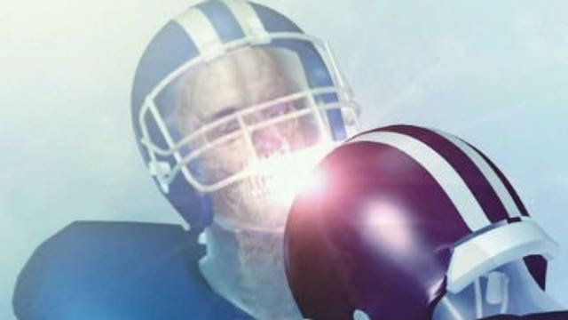 NFL and GE team up to take on concussions