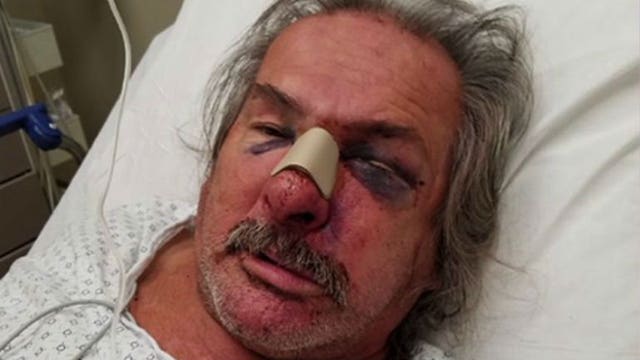 "Totally uncalled for:" 58-year-old man in ICU after altercation outside south side bar turns physical