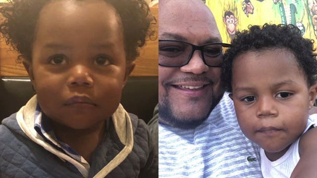 Mother charged with child neglect after 2-year-old son burned with lighter throughout his body