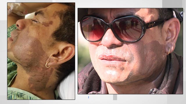 Police arrest 61-year-old man near scene of acid attack at 13th and Cleveland