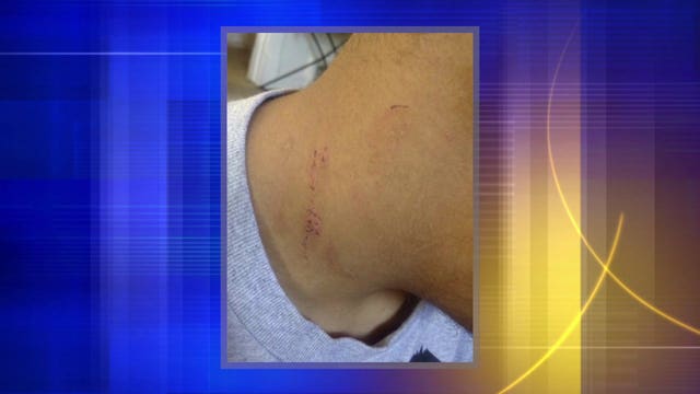 "There's no excuse:" Woman says son with Down syndrome punched by teacher's aide at MPS school