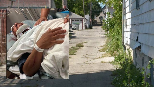 Milwaukee man suffers lost vision, concussion after beating on city's south side