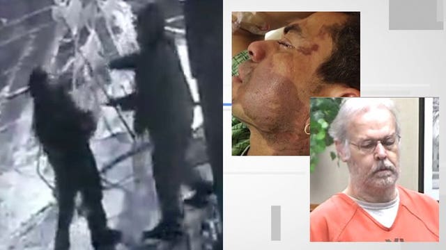 Arraignment set for man charged in hate crime acid attack