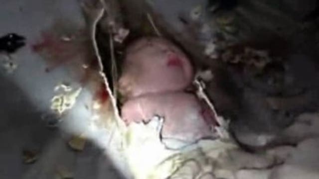 Mom of baby saved from toilet pipe sorry he ended up there