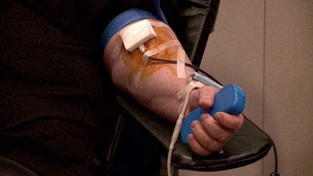 Versiti blood centers to collect plasma to help treat those severely ill with COVID-19