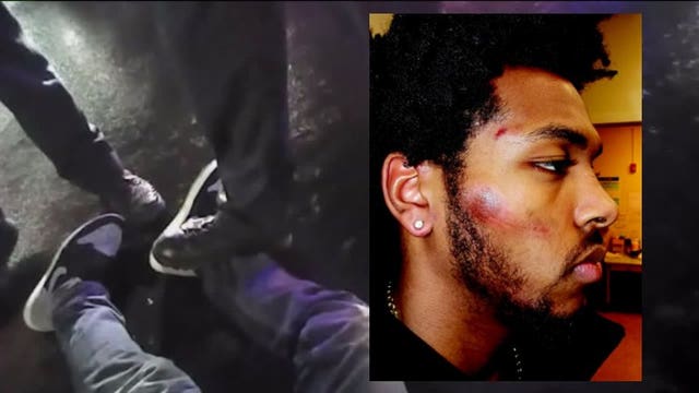 Sterling Brown's attorney calls city's 51-page response to lawsuit, which blames Brown, an 'absurd accusation'