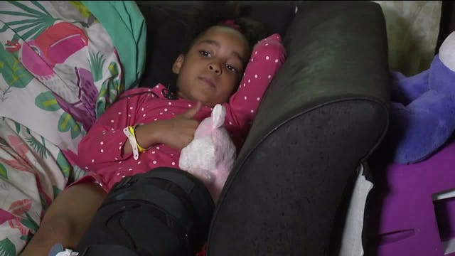 "Please come forward:" 5-year-old to spend summer in wheelchair after hit-and-run crash