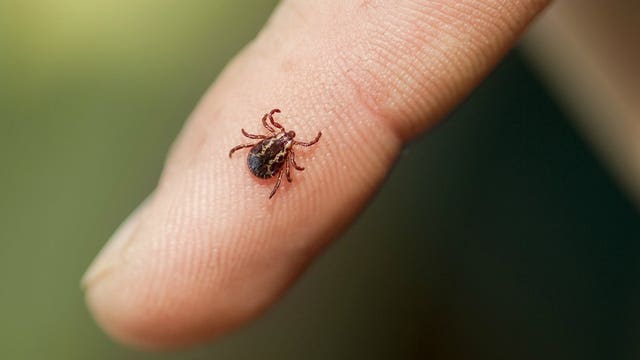 Tick-borne disease with symptoms similar to COVID-19 on the rise in New York state