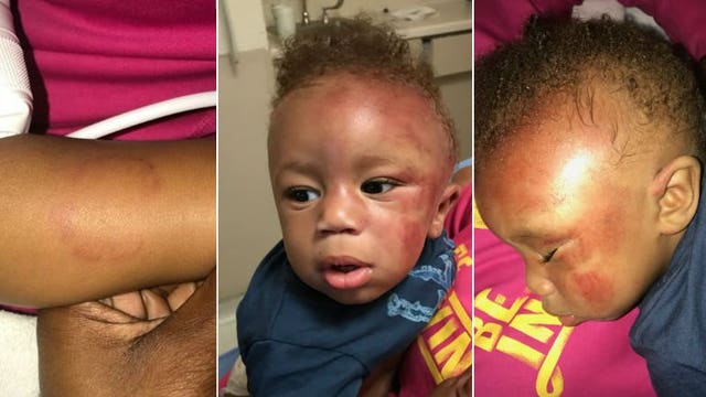 Police: Day care worker arrested after mother alleged 8-month-old son suffered abuse