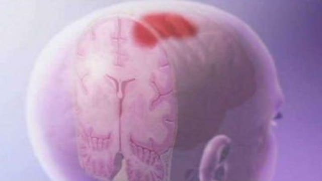 Joint concussion study announced: Obama calls for end to "suck it up" culture in sports