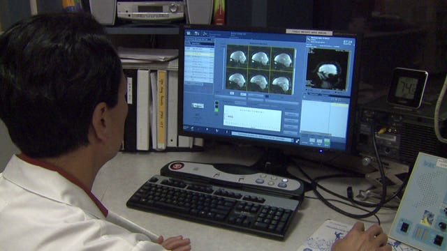 "How long does it take for the brain to recover?" MCW researchers studying WI athletes and concussions