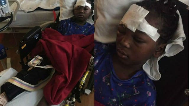 Driver stayed on scene after 7-year-old struck near 27th and Burleigh: "Just happy she's alive"