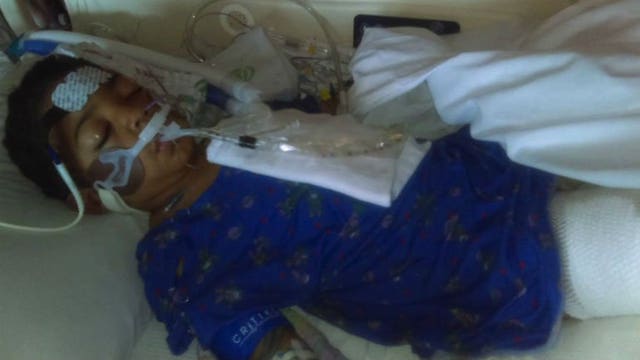 "Whoever did this is a monster:" Boy suffers burns in fire believed to be arson