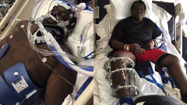 Family raises money for wheelchair ramp for boy hit by car on way to school: 'Only way he can come home'