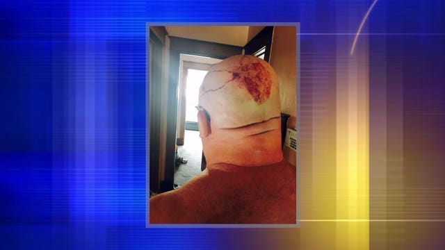 Realtor showing home pistol whipped, robbed at gunpoint in broad daylight: "I feared for my life"