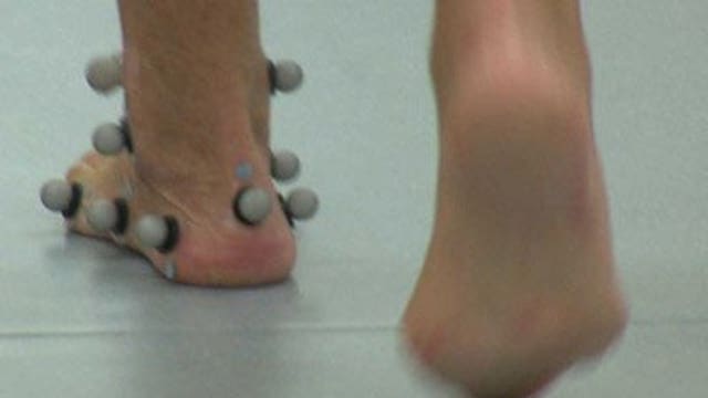 Gait Lab helps doctors treat problems with feet, ankles, knees and hips