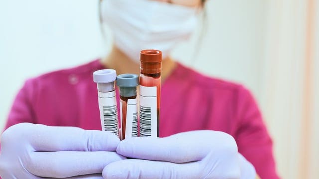 Blood tests could determine a person's immunity to further COVID-19 problems