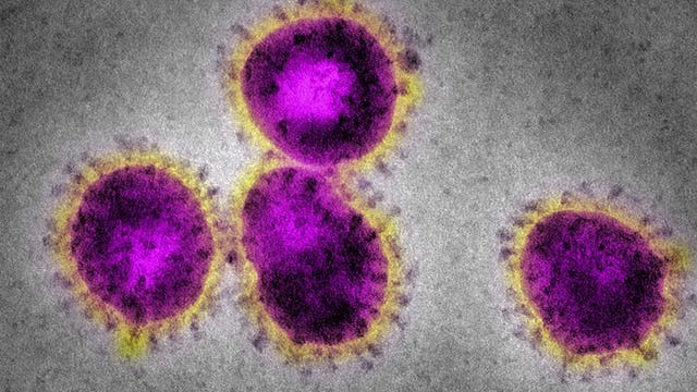 UW-Platteville monitors 6 students for coronavirus who just returned from Wuhan, China