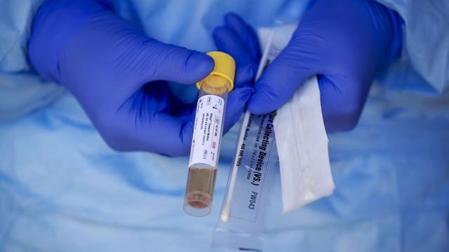 FDA clears test to detect coronavirus in 5 minutes