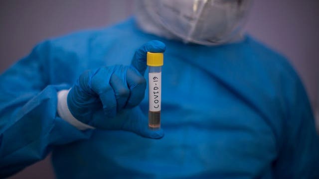 American Medical Association cautions physicians, public about COVID-19 antibody test limitations