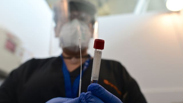 FDA warns labs about high risk of false positives from medical company’s COVID-19 test