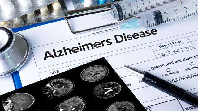 1st blood test to help diagnose Alzheimer's goes on sale