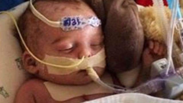 Too graphic? That's what Facebook says of a photo featuring a newborn that needs a new heart