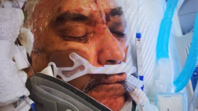 'Pray for a miracle:' 68-year-old man clings to life after he was struck by vehicle, left for dead