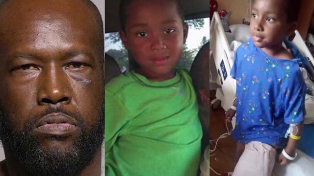 'I don't deserve this:' 7-year-old boy shot in Milwaukee forced to have leg amputated