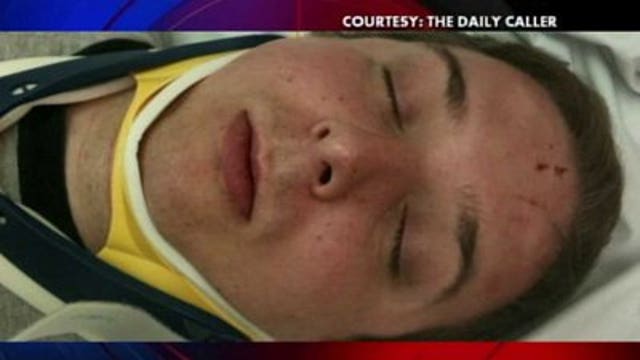 Madison campaign volunteer recants story about being attacked