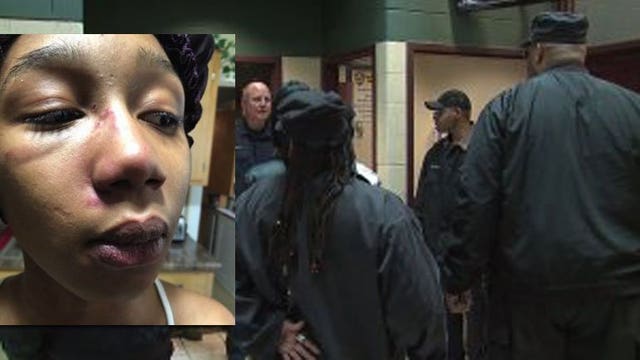 Mother says 16-year-old daughter left bloody, bruised after encounter with West Allis police officers