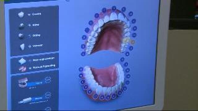 High tech dental scanner means fewer visits